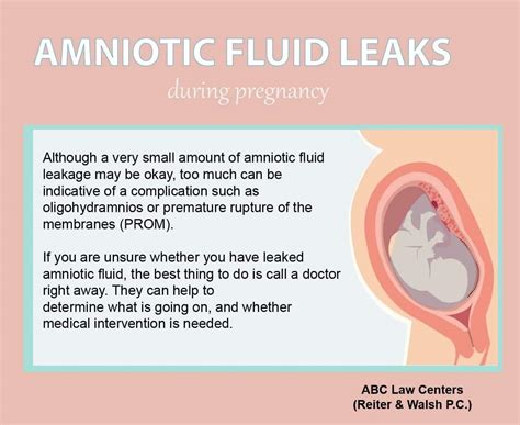 how to tell if your leaking amniotic fluid|Leaking Amniotic Fluid: Signs, Causes, and Symptoms